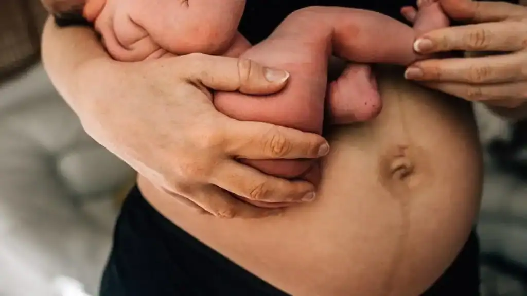 Why Is My Stomach Still Big After Pregnancy Yorkhill?